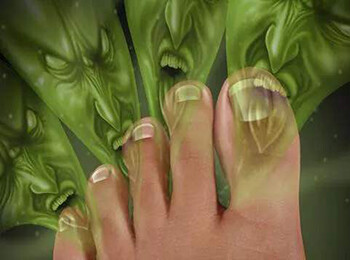 How to control foot odor in socks